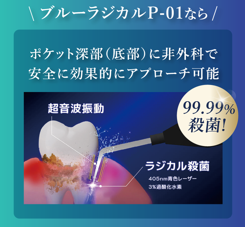 ブルーラジカルP-01ならポケット深部に非外科で安全に効果的にアプローチ可能